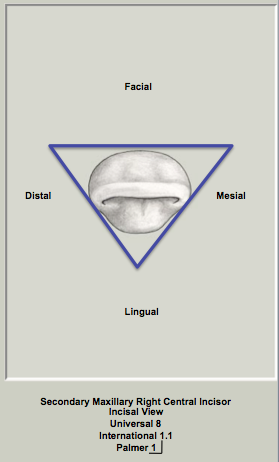 Mx Central Incisal Triangular.png